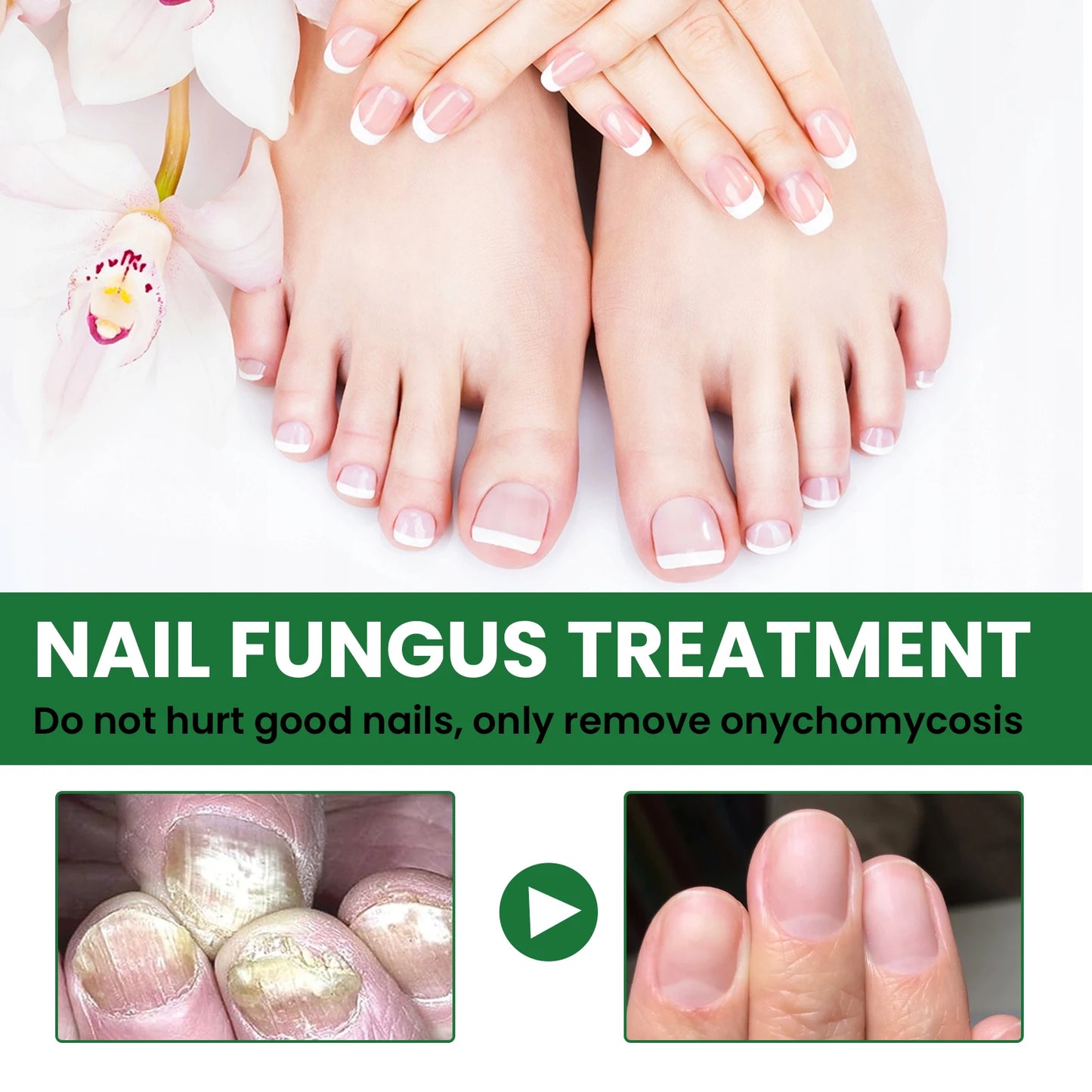 Nail Repair & Strengthening Liquid – Brightening Treatment