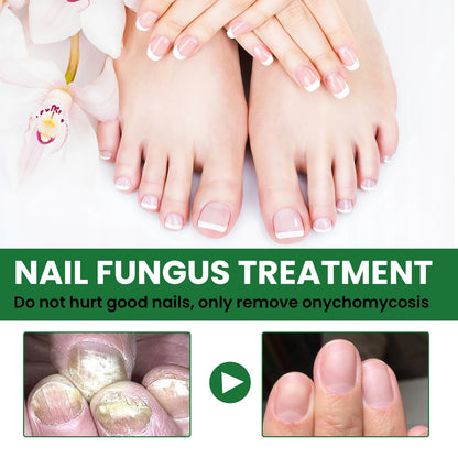Nail Repair & Strengthening Liquid – Brightening Treatment