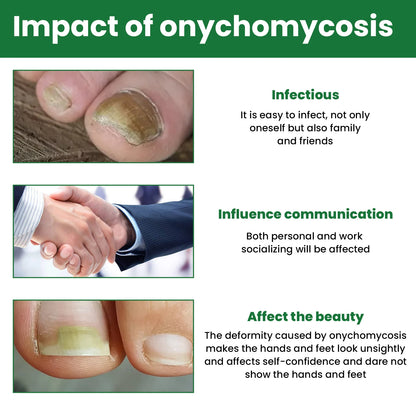 Nail Repair & Strengthening Liquid – Brightening Treatment