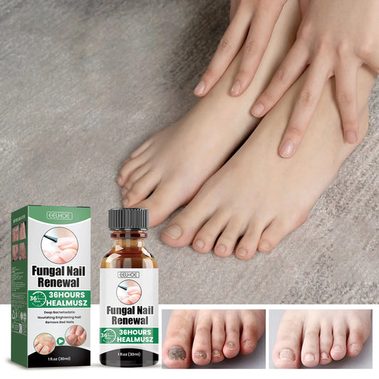 Nail Repair & Strengthening Liquid – Brightening Treatment
